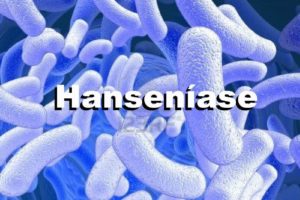 hanseniase-bacilo-banner.jpg-514c2b0d4788c