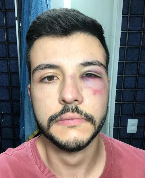 Após reagir a assalto, jornalista Matheus Ribeiro é agredido: “não fiz o correto”