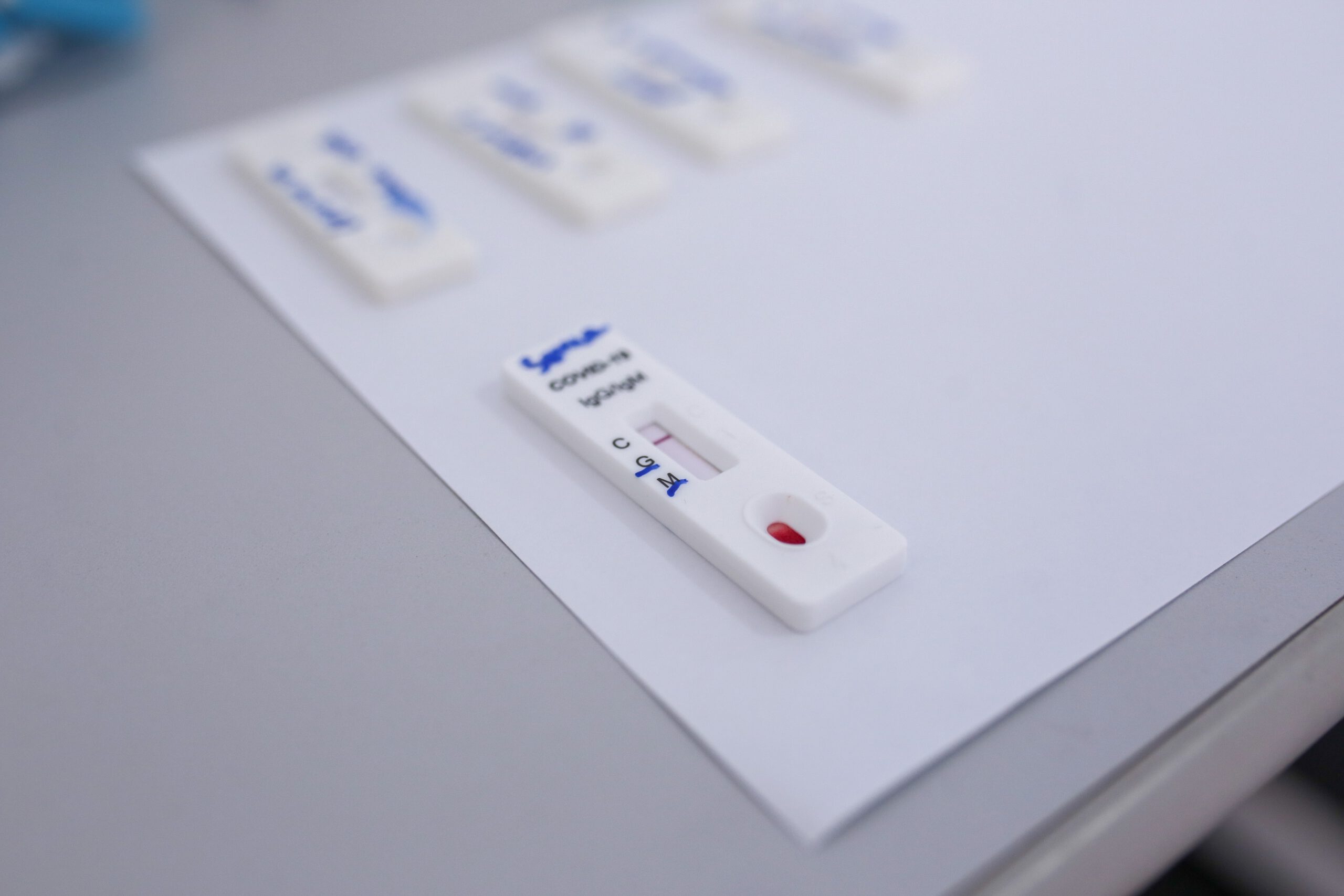 Laboratório detecta aumento significativo de infectados por covid-19 (Foto Divulgação).