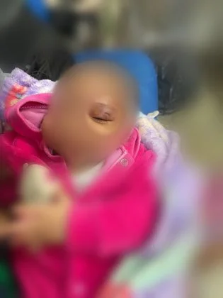 Preso suspeito de agredir filha de 1 mês com socos, em Planaltina