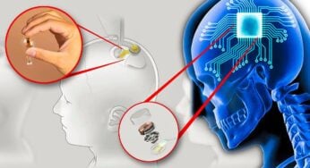 Neuralink: agência aprova chip de Elon Musk para lançar primeiro estudo clínico em humanos