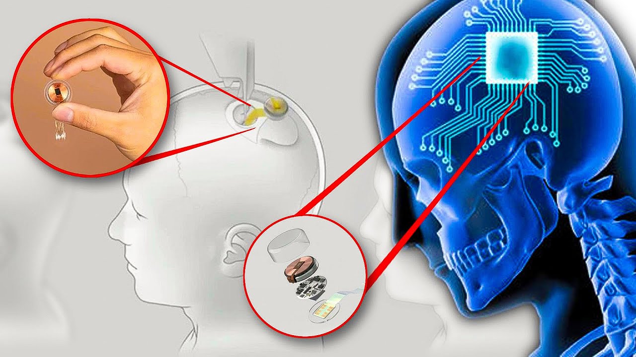 Neuralink